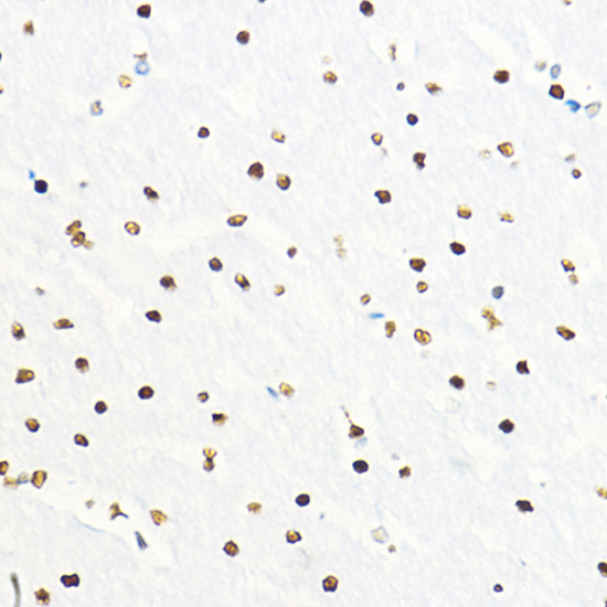 ZEB2 Rabbit polyclonal antibody