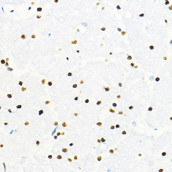 ZEB2 Rabbit polyclonal antibody