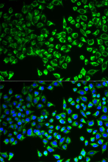 CS Rabbit polyclonal antibody