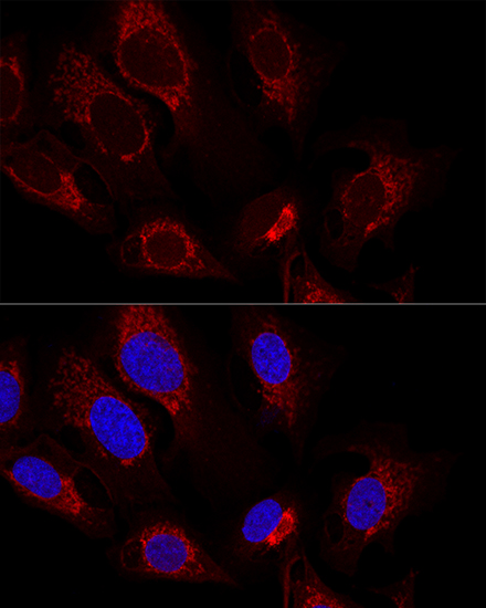 CS Rabbit polyclonal antibody