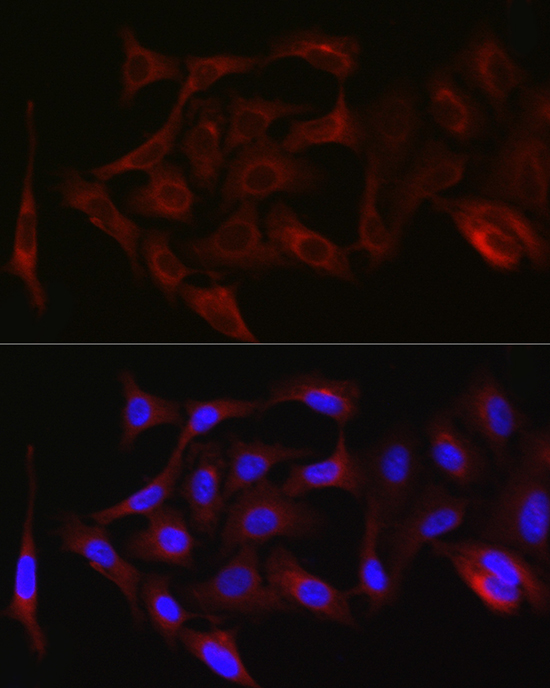 PKC zeta Rabbit polyclonal antibody