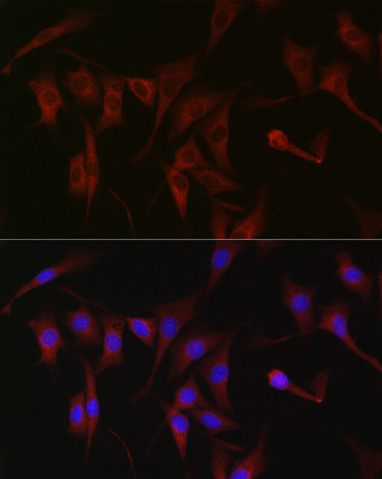 PKC zeta Rabbit polyclonal antibody