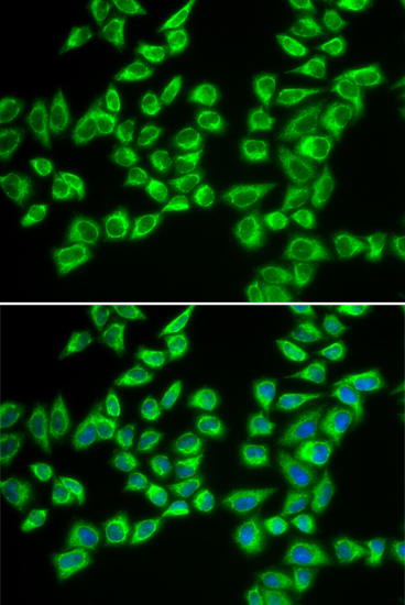 HADHB Rabbit polyclonal antibody