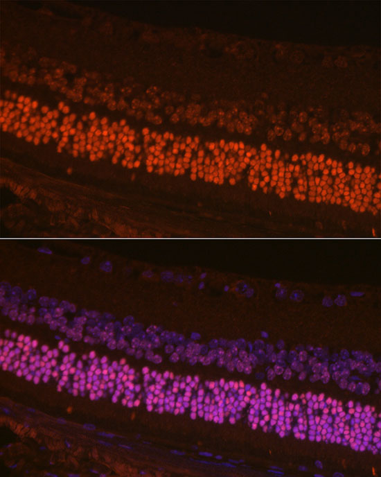 CRX Rabbit polyclonal antibody