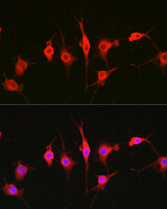 Heparanase 1 Rabbit polyclonal antibody