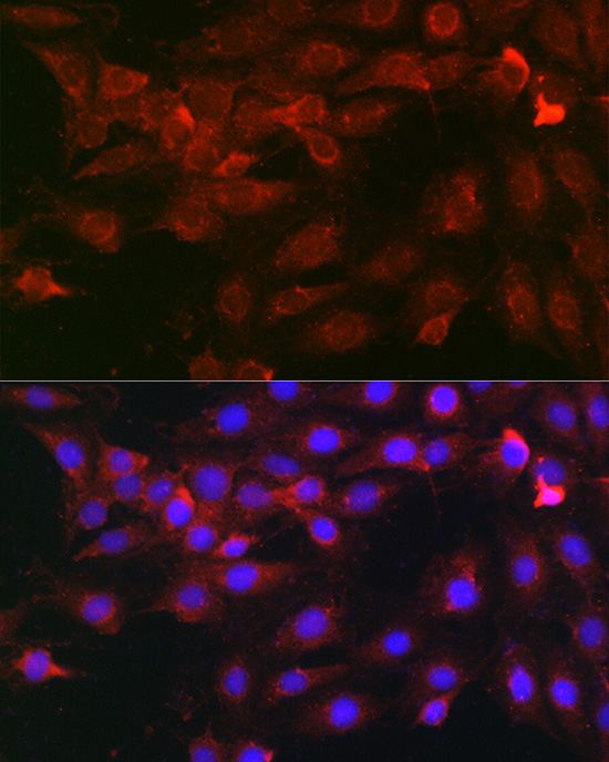 Heparanase 1 Rabbit polyclonal antibody