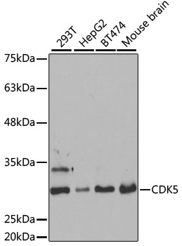 [KO Validated] CDK5 Rabbit polyclonal antibody