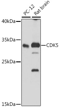 [KO Validated] CDK5 Rabbit polyclonal antibody