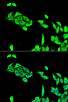 [KO Validated] CDK5 Rabbit polyclonal antibody