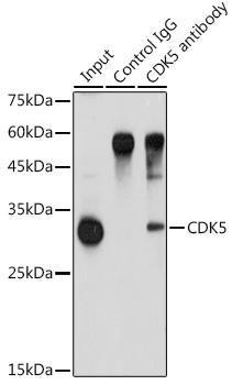 [KO Validated] CDK5 Rabbit polyclonal antibody