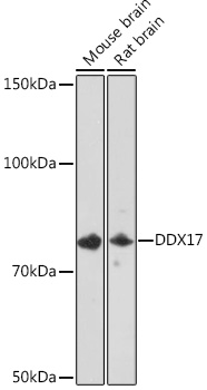 DDX17 Rabbit monoclonal antibody