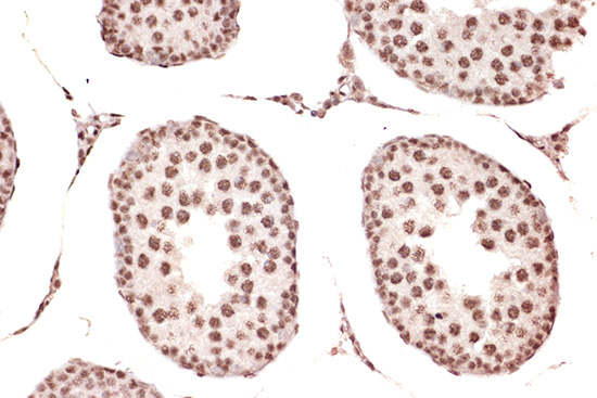 DDX17 Rabbit monoclonal antibody
