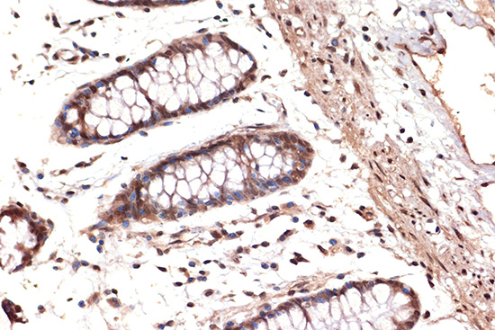 DDX17 Rabbit monoclonal antibody