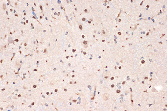 DDX17 Rabbit monoclonal antibody