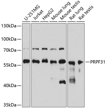 PRPF31 Rabbit polyclonal antibody