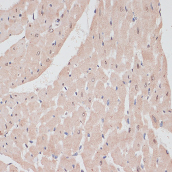 PRPF31 Rabbit polyclonal antibody
