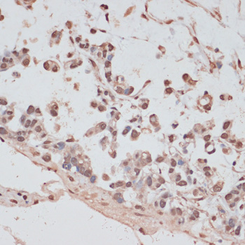 PRPF31 Rabbit polyclonal antibody