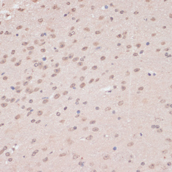 PRPF31 Rabbit polyclonal antibody
