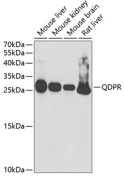 QDPR Rabbit polyclonal antibody