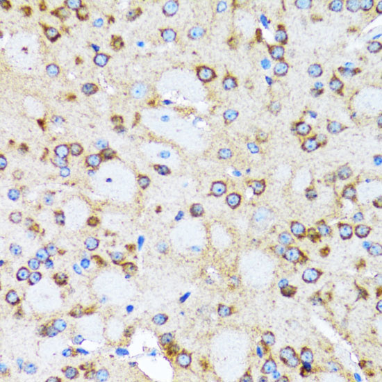 Arp2 Rabbit polyclonal antibody