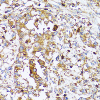 Arp2 Rabbit polyclonal antibody