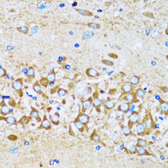 Arp2 Rabbit polyclonal antibody
