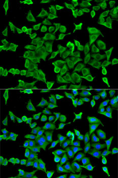 Arp2 Rabbit polyclonal antibody
