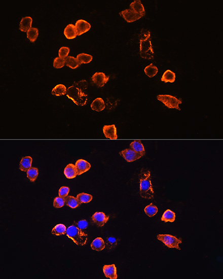 CD14 Rabbit polyclonal antibody