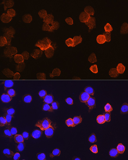 CD14 Rabbit polyclonal antibody