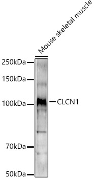 CLCN1 Rabbit polyclonal antibody