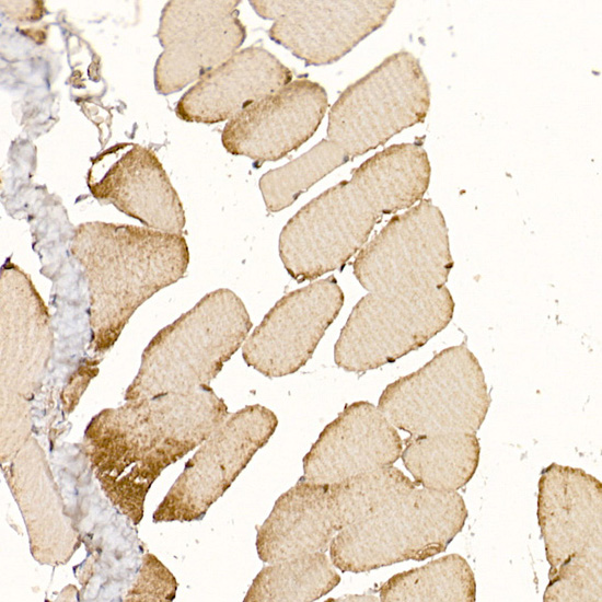CLCN1 Rabbit polyclonal antibody