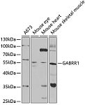 Western blot - GABRR1 Rabbit pAb (A5745)