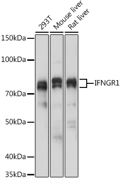 IFNGR1 Rabbit polyclonal antibody