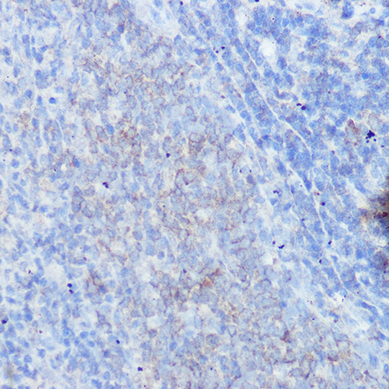 IFNGR1 Rabbit polyclonal antibody