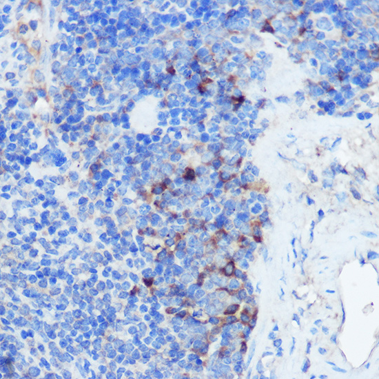IFNGR1 Rabbit polyclonal antibody