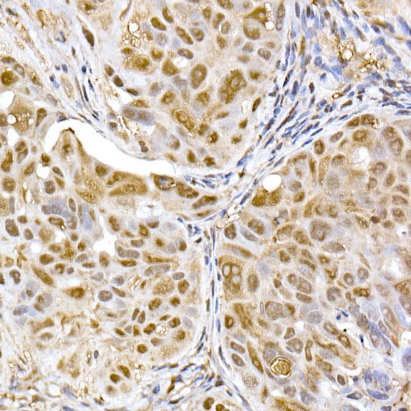 PSMA5 Rabbit polyclonal antibody