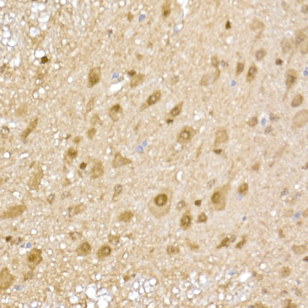 PSMA5 Rabbit polyclonal antibody