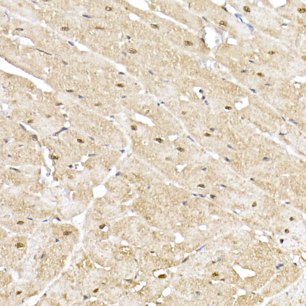 PSMA5 Rabbit polyclonal antibody