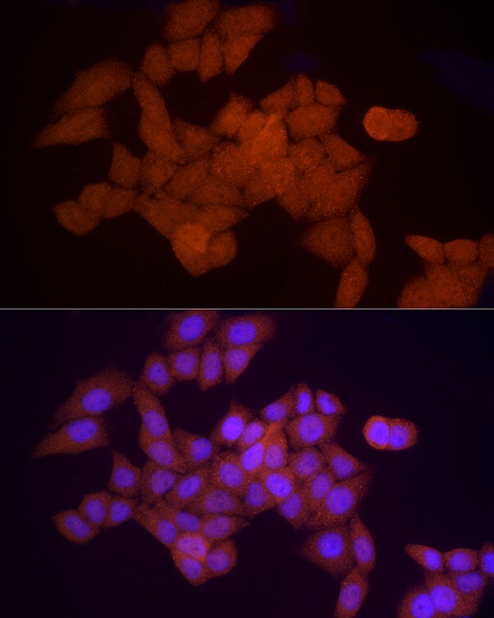 PSMA5 Rabbit polyclonal antibody