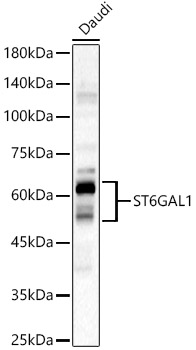 ST6GAL1 Rabbit polyclonal antibody