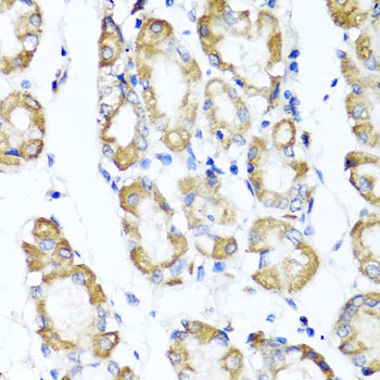 ST6GAL1 Rabbit polyclonal antibody