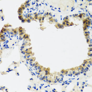 ST6GAL1 Rabbit polyclonal antibody