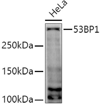 53BP1 Rabbit polyclonal antibody