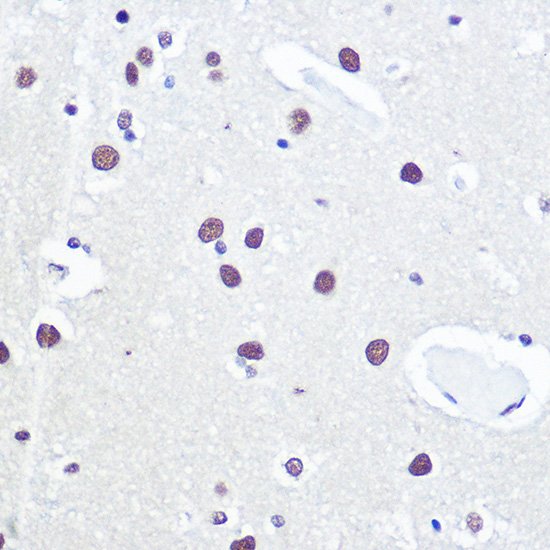53BP1 Rabbit polyclonal antibody