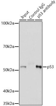 p53 Rabbit polyclonal antibody