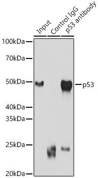 p53 Rabbit polyclonal antibody