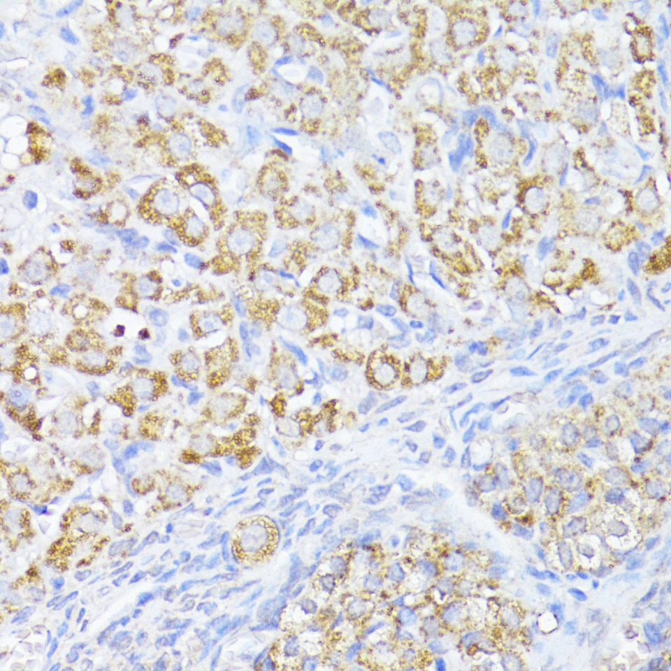 MAVS Rabbit polyclonal antibody