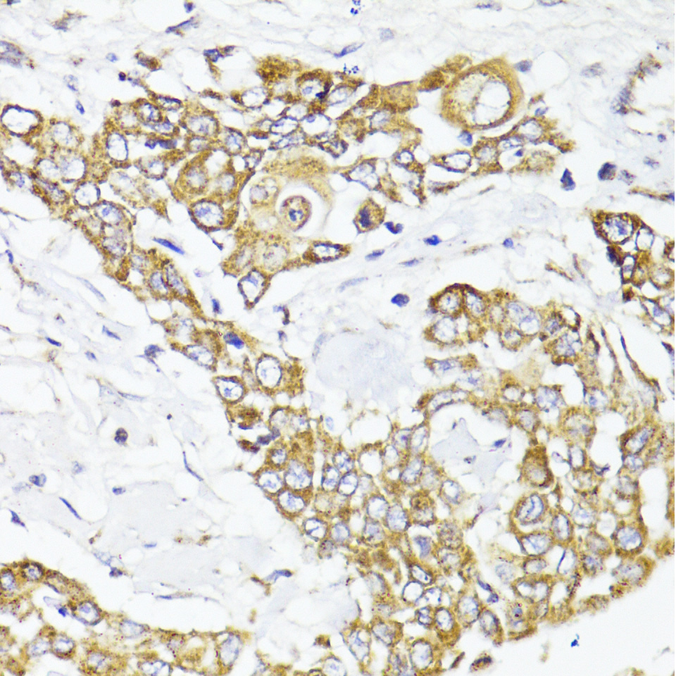 MAVS Rabbit polyclonal antibody