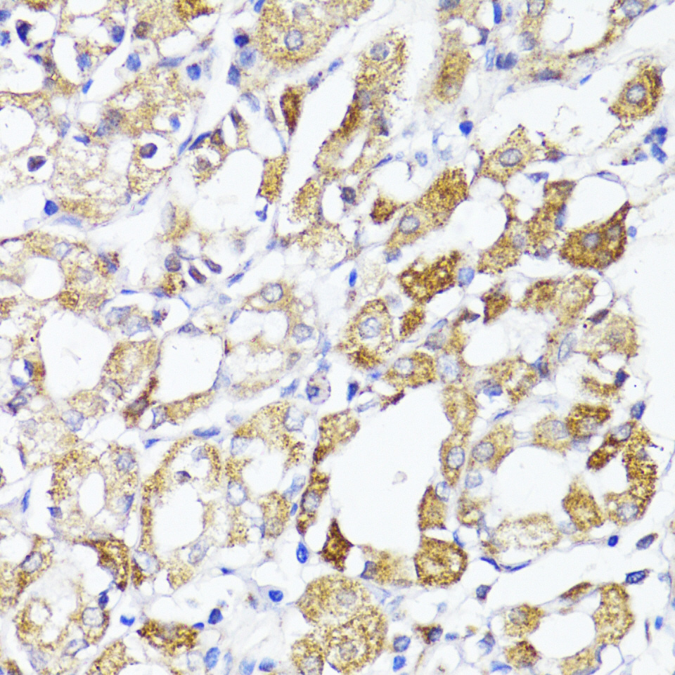 MAVS Rabbit polyclonal antibody