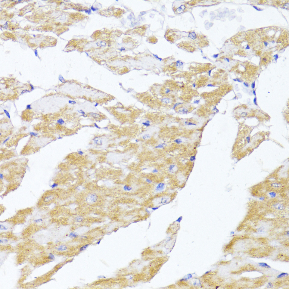 MAVS Rabbit polyclonal antibody